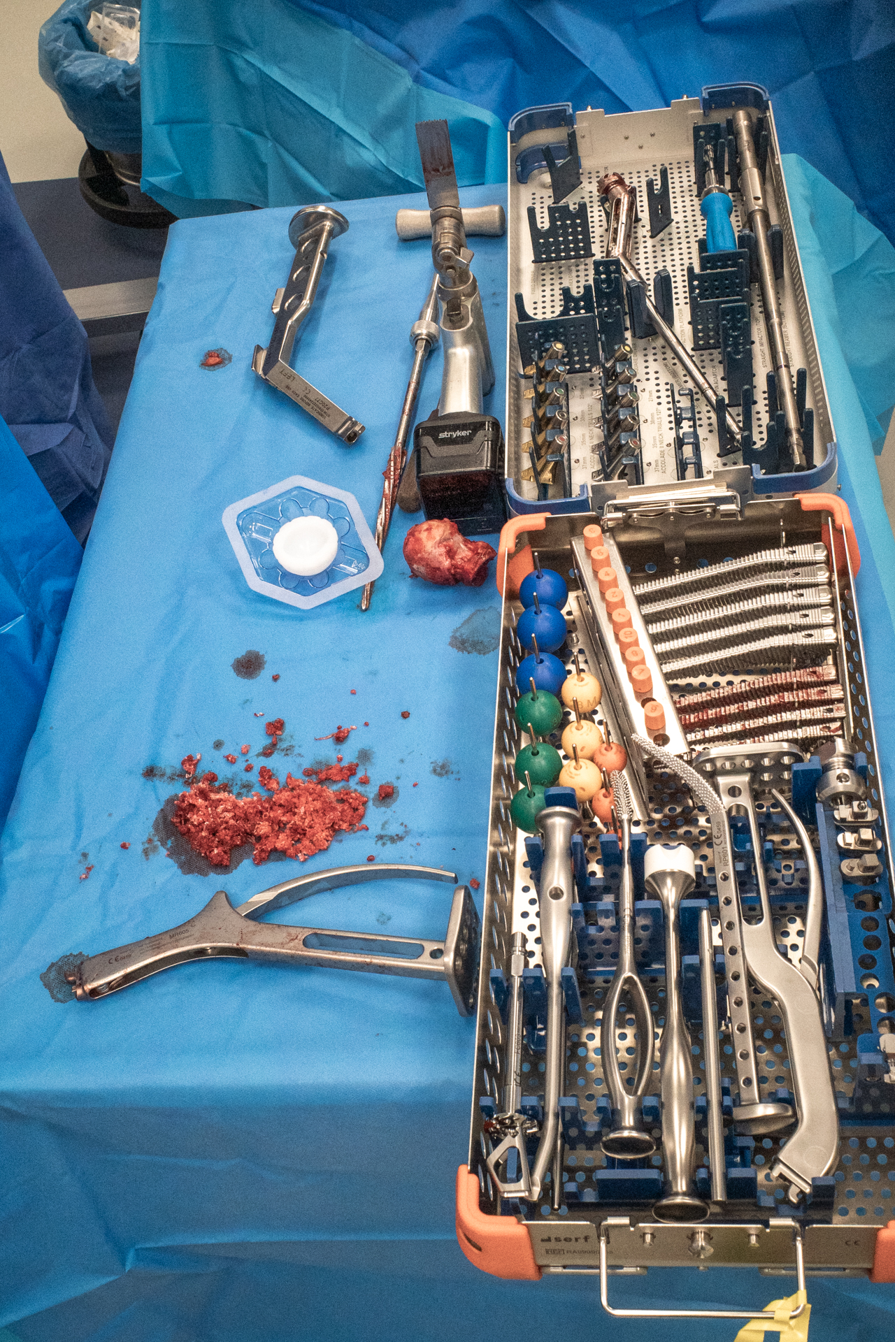 3 months in a surgery room.